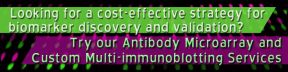 
      Looking for a cost-effective strategy for biomarker discovery and validation?
      Try our Antibody Microarray and Custom Multi-immunoblotting Services.
    