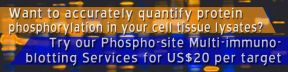 
      Want to accurately quantify protein phosphorylation in your cell/tissue lysates?
      Try our Phospho-site Multi-immunoblotting Services for ~US$20 per target.
    