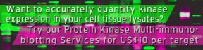 
      Want to accurately quantify protein kinase expression in your cell/tissue lysates?
      Try our Kinase Multi-immunoblotting Services for US$10 per target.
    
